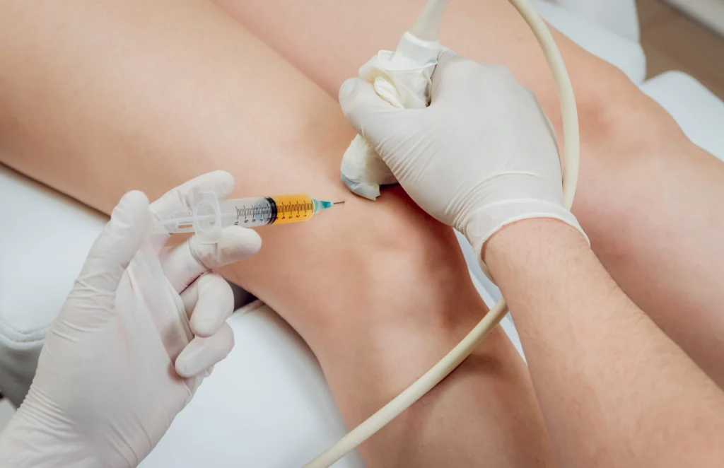 PRP Therapy for Pain and Tendonitis