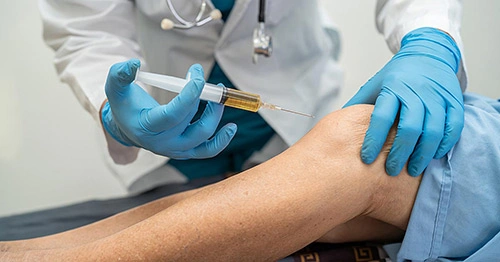 Best PRP Treatment for Knee Pain
