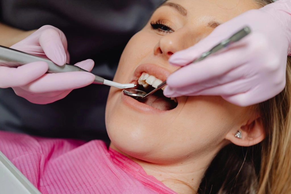 Benefits of PRF in Dentistry